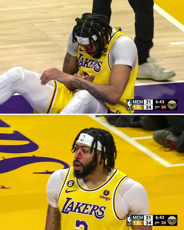 南宫28- FPX不断突破!,浓眉哥连续十二场比赛得分超过夺冠热度持续攀升